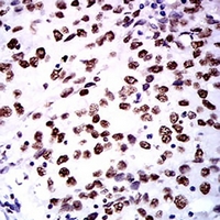 19 - Anti-ZFP91 Antibody AP96129