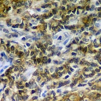 19 - Anti-CD86 Antibody AP96130