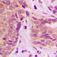 19 - Anti-GSTP1 Antibody AP96132