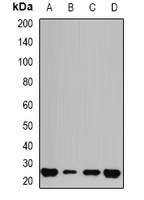 1 - Anti-GSTP1 Antibody AP96132