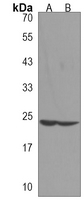 1 - Anti-JOSD2 Antibody AP96135