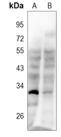 1 - Anti-CD37 Antibody AP96136