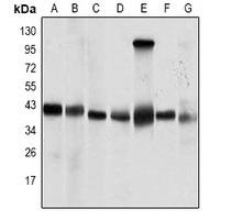 1 - Anti-PP2C-alpha Antibody AP96138