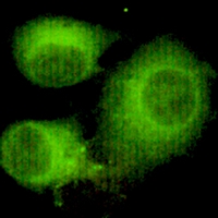 3 - Anti-ACLY Antibody AP96141
