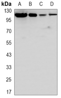1 - Anti-ACLY Antibody AP96141