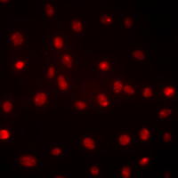 3 - Anti-DDX39B Antibody AP96142