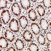 19 - Anti-DDX39B Antibody AP96142