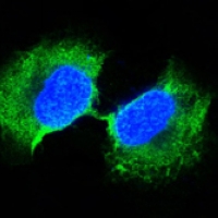 3 - Anti-GSTP1 Antibody AP96144