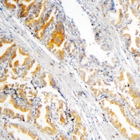 19 - Anti-GSTP1 Antibody AP96144