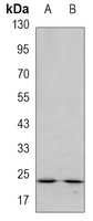 1 - Anti-GSTP1 Antibody AP96144