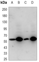 1 - Anti-Metadherin Antibody AP96145