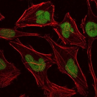 3 - Anti-MCM2 Antibody AP96146