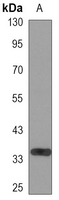 1 - Anti-Kallikrein 3 Antibody AP96147