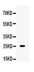 1 - Anti-TNF alpha Picoband Antibody ABO10001