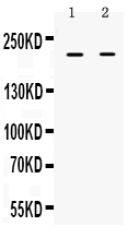 1 - Anti-BRCA1 Picoband Antibody ABO10002