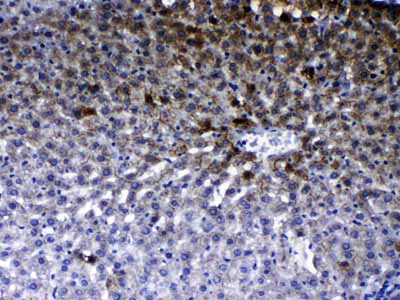 2 - Anti-ErbB 2 Picoband Antibody ABO10004