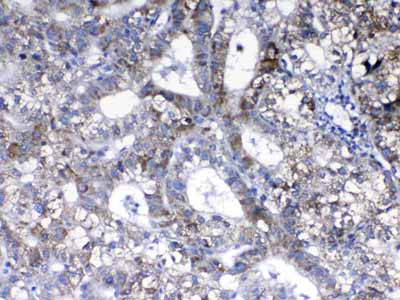 2 - Anti-ErbB 2 Picoband Antibody ABO10004