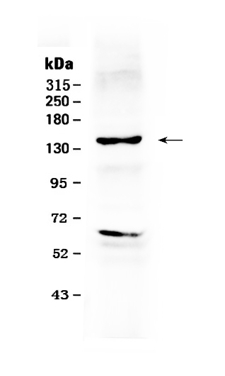 1 - Anti-ErbB 2 Picoband Antibody ABO10004