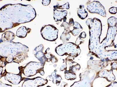 2 - Anti-TFPI2 Picoband Antibody ABO10008