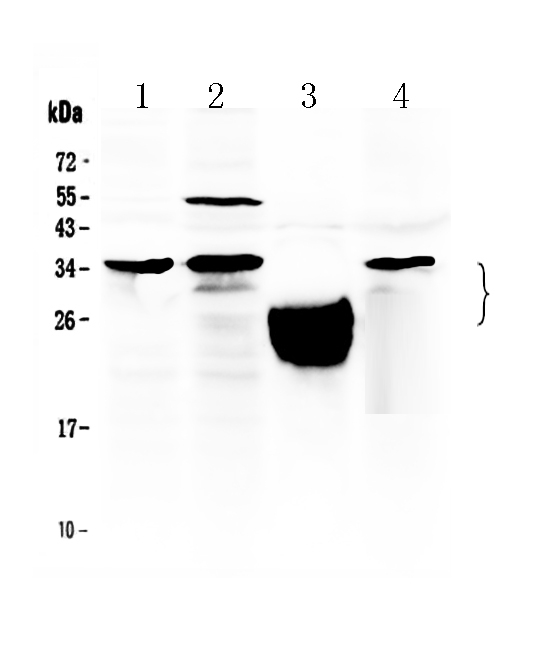 1 - Anti-TFPI2 Picoband Antibody ABO10008