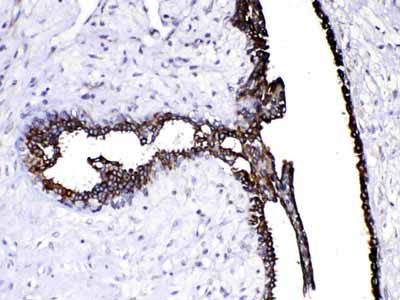 2 - Anti-Caspase 8 Picoband Antibody ABO10010