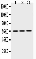 1 - Anti-Caspase 8 Picoband Antibody ABO10010