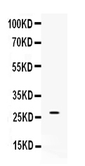 1 - Anti-VEGF Antibody ABO10012