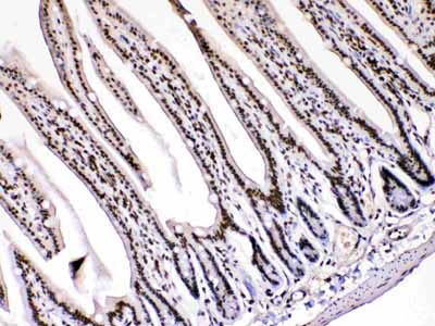 2 - Anti-HMGB1 Picoband Antibody ABO10014