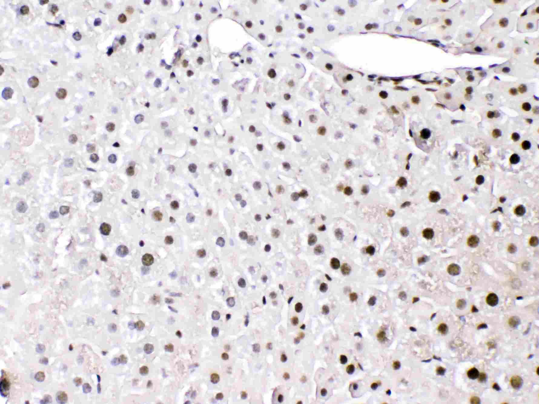 2 - Anti-HMGB1 Picoband Antibody ABO10014
