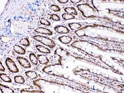 2 - Anti-HMGB1 Picoband Antibody ABO10014