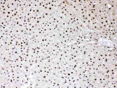 2 - Anti-HMGB1 Picoband Antibody ABO10014