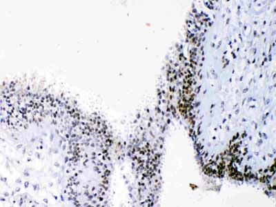 2 - Anti-HMGB1 Picoband Antibody ABO10014