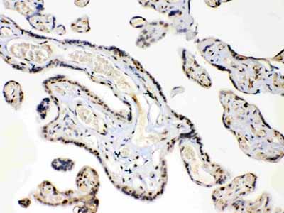 2 - Anti-HMGB1 Picoband Antibody ABO10014