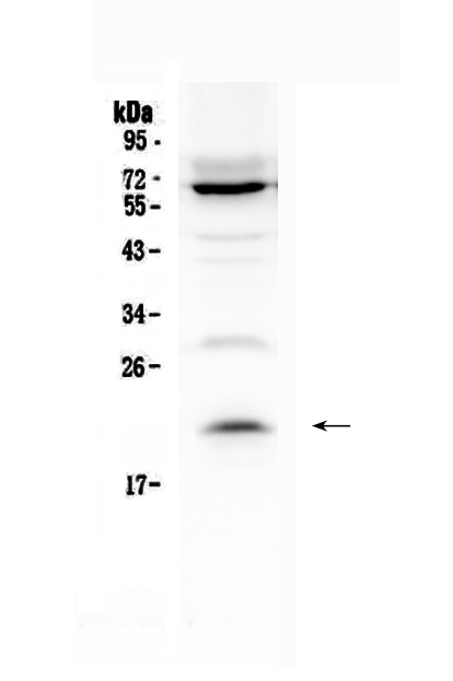 1 - Anti-IL13 Picoband Antibody ABO10015