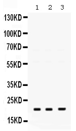 1 - Anti-GTPase HRAS Picoband Antibody ABO10021