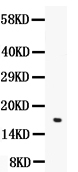 1 - Anti-Angiogenin/ANG Picoband Antibody ABO10025