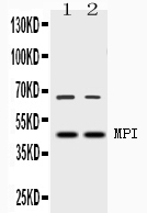1 - Anti-MPI Picoband Antibody ABO10033