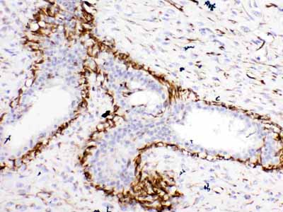 2 - Anti-Bcl-XL Picoband Antibody ABO10035