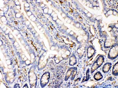 2 - Anti-Bax Picoband Antibody ABO10036
