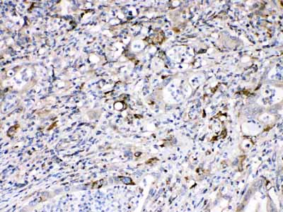 2 - Anti-Bax Picoband Antibody ABO10036