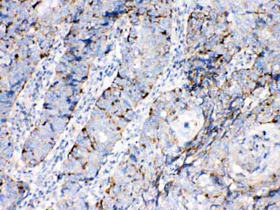 2 - Anti-Bax Picoband Antibody ABO10036