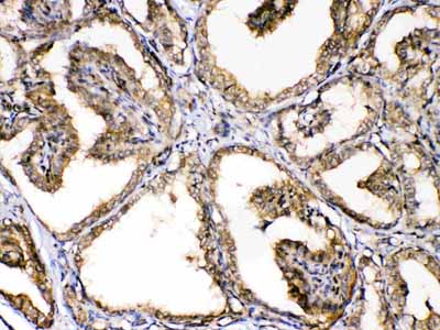 2 - Anti-GAPDH Picoband Antibody ABO10041