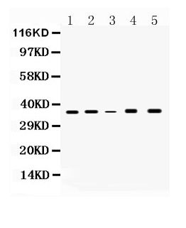 1 - Anti-GAPDH Picoband Antibody ABO10041