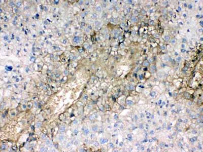 2 - Anti-Hemoglobin Picoband Antibody ABO10043