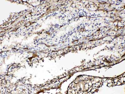 2 - Anti-Hemoglobin Picoband Antibody ABO10043