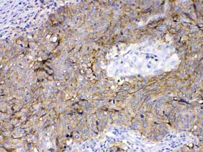 2 - Anti-CD147/Emmprin Picoband Antibody ABO10044