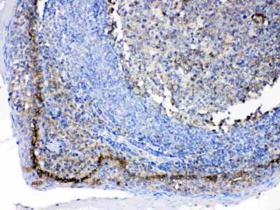 2 - Anti-CD147/Emmprin Picoband Antibody ABO10044