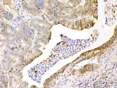 2 - Anti-CD147/Emmprin Picoband Antibody ABO10044