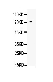 1 - Anti-MMP2 Picoband Antibody ABO10048