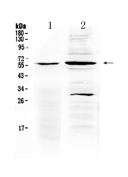 1 - Anti-TNFRSF1A Picoband Antibody ABO10050